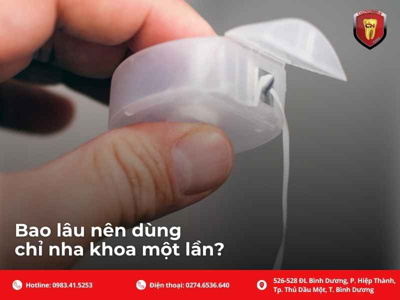 Bao lâu nên dùng chỉ nha khoa một lần?