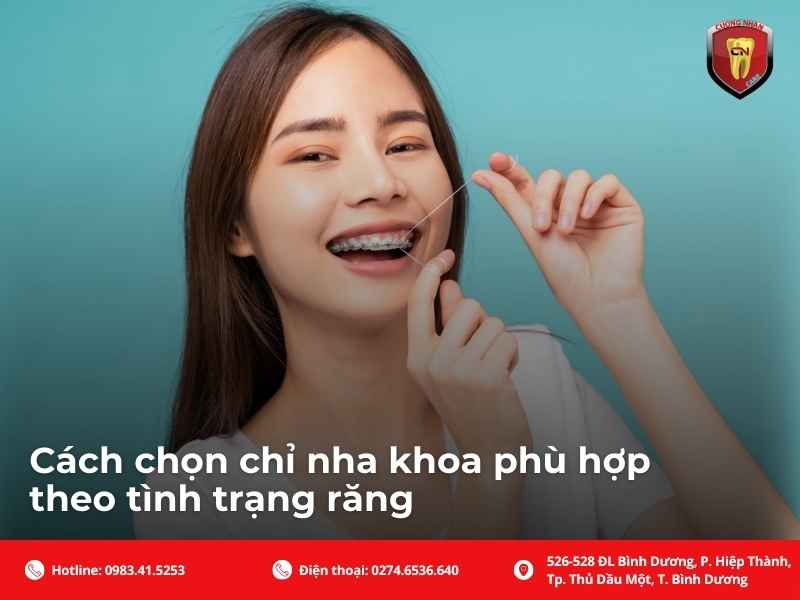 Cách chọn chỉ nha khoa phù hợp theo tình trạng răng