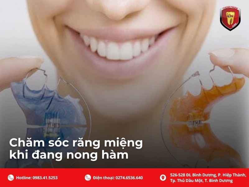 Chăm sóc răng miệng khi đang nong hàm