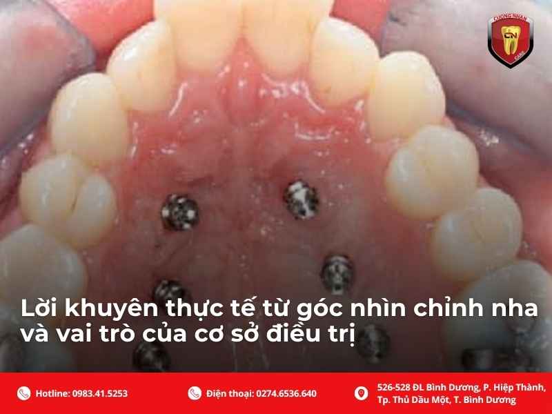 Gợi ý chuẩn bị trước khi bắt đầu để bạn chủ động hơn