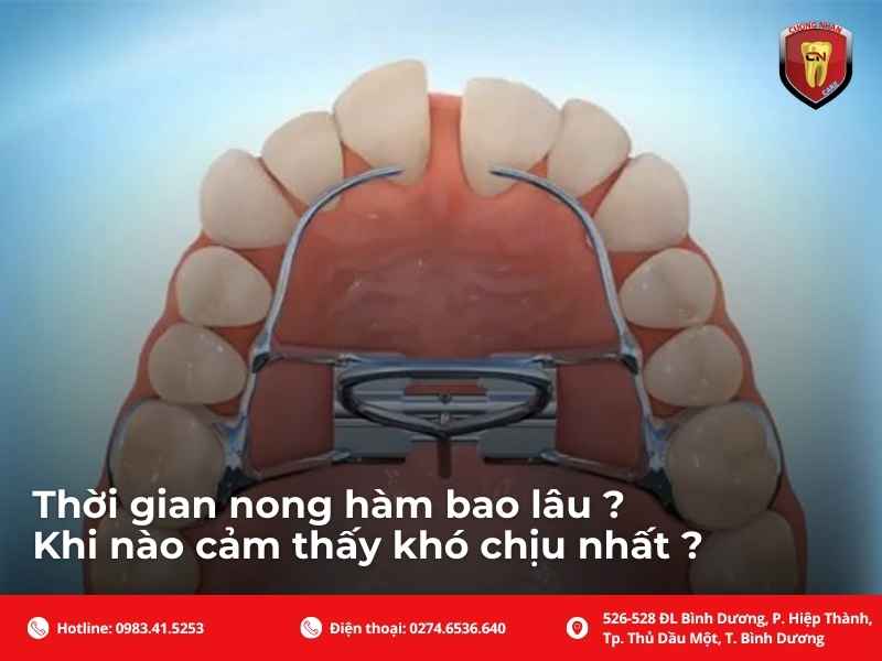 Trẻ em và người lớn - Ai dễ khó chịu hơn khi nong ?