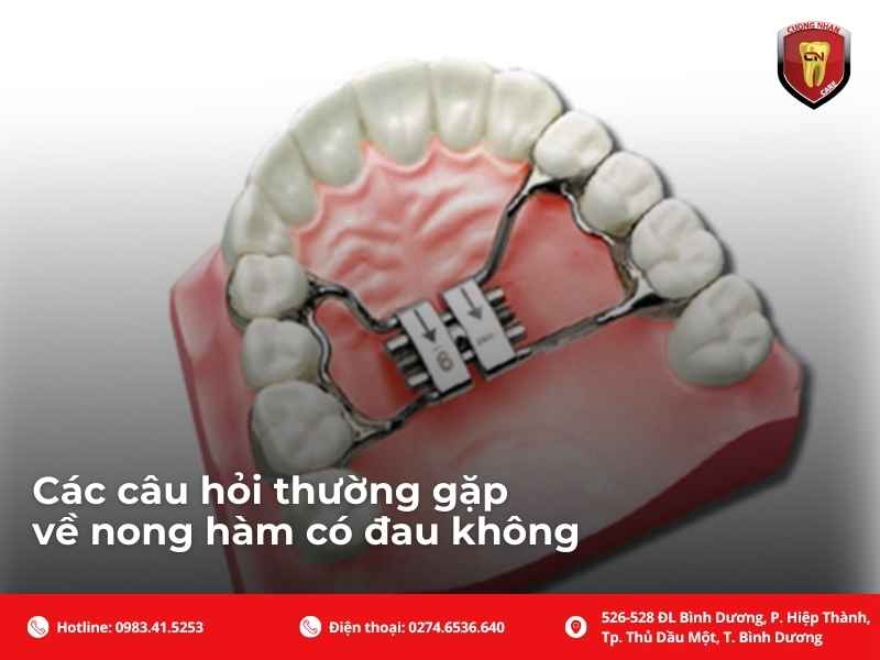 Nong hàm có nguy hiểm không và những vấn đề có thể gặp