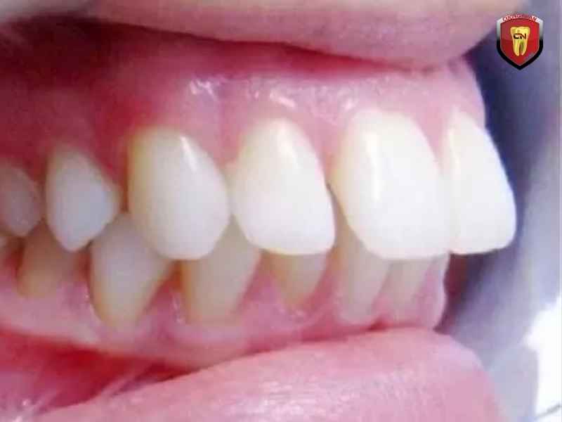 Mức độ trung bình