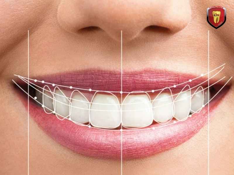 Làm nụ cười và khuôn mặt kém cân đối