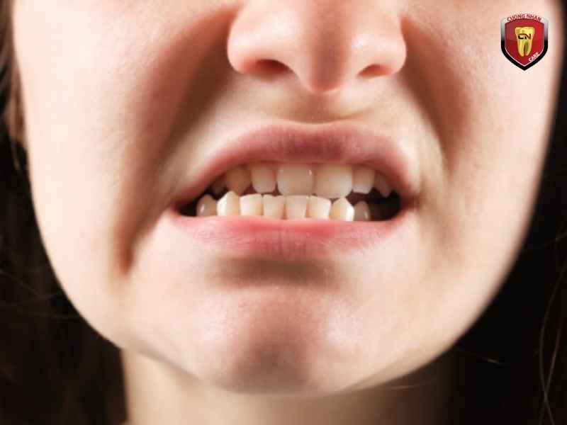 Gây sai khớp cắn và giảm khả năng cắn xé