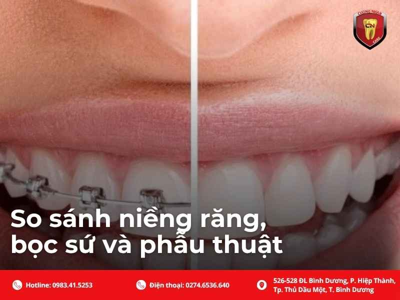 So sánh niềng răng, bọc sứ và phẫu thuật