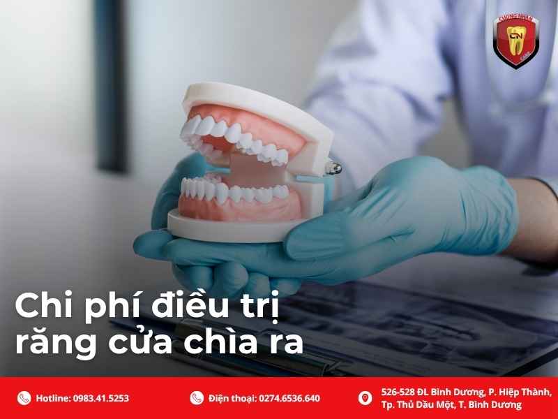 Chi phí điều trị răng cửa chìa ra