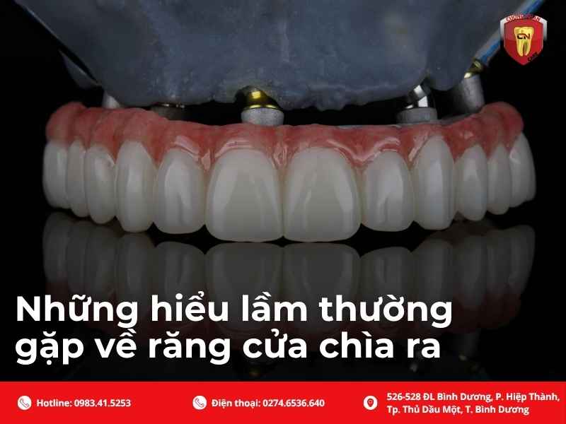 Những hiểu lầm thường gặp về răng cửa chìa ra
