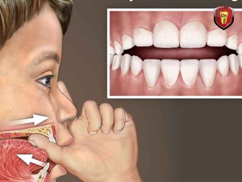 Thói quen xấu từ nhỏ