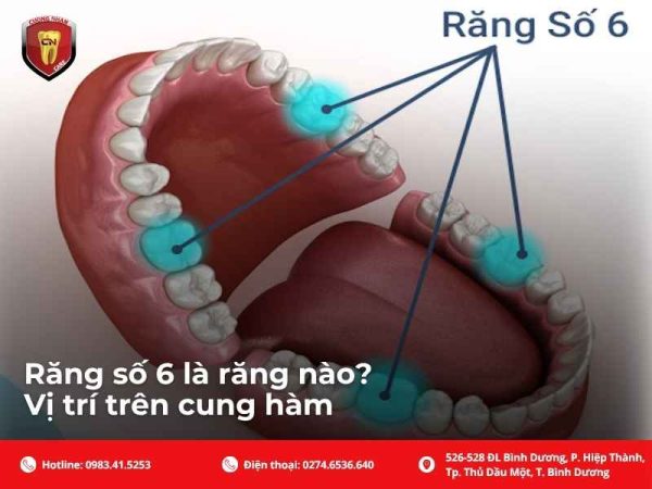 Cổ răng là vị trí dễ tích tụ mảng bám
