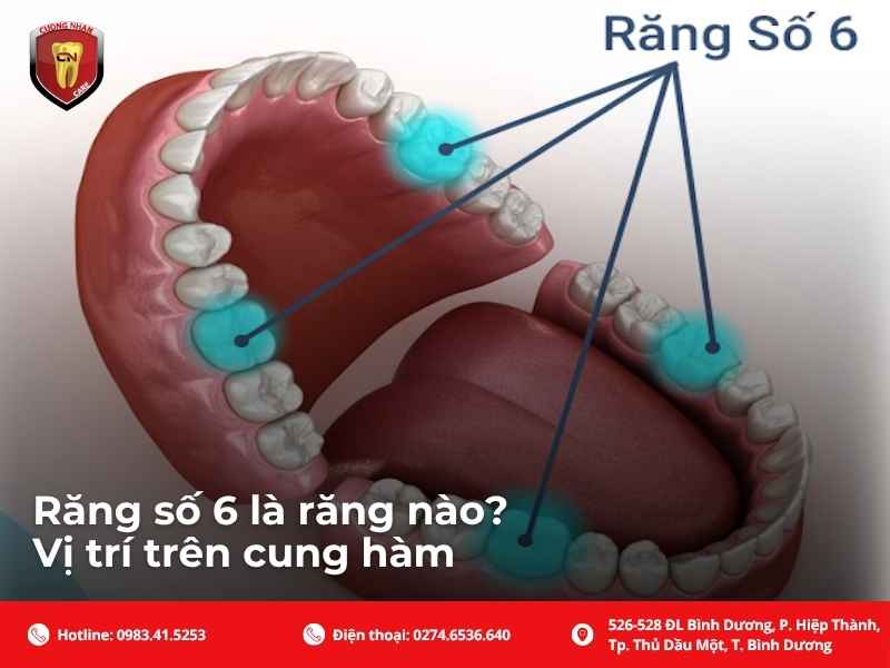 Cổ răng là vị trí dễ tích tụ mảng bám