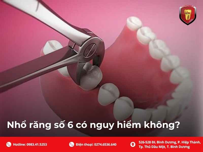 Nhổ răng số 6 có nguy hiểm không?