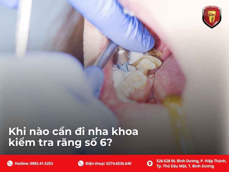 Khi nào cần đi nha khoa kiểm tra răng số 6?