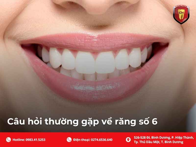 Câu hỏi thường gặp về răng số 6