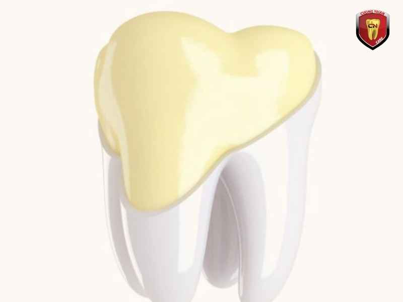 Ngà răng chiếm phần lớn cấu trúc thân răng