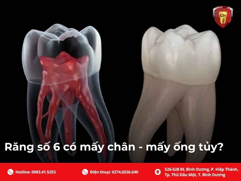 Răng số 6 mọc khi nào? Có thay không?