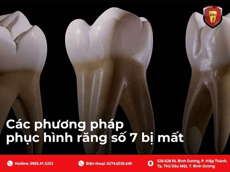 Các phương pháp phục hình răng số 7 bị mất