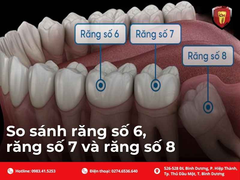 So sánh răng số 6, răng số 7 và răng số 8