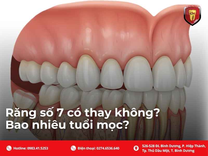 Răng số 7 có thay không? Bao nhiêu tuổi mọc?