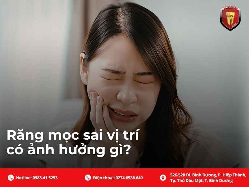 Răng mọc sai vị trí có ảnh hưởng gì?