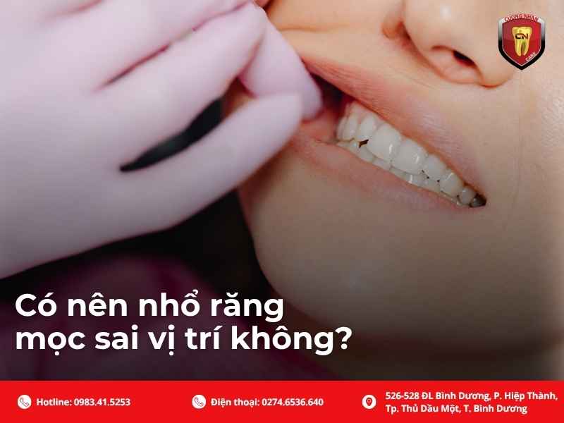 Có nên nhổ răng mọc sai vị trí không?