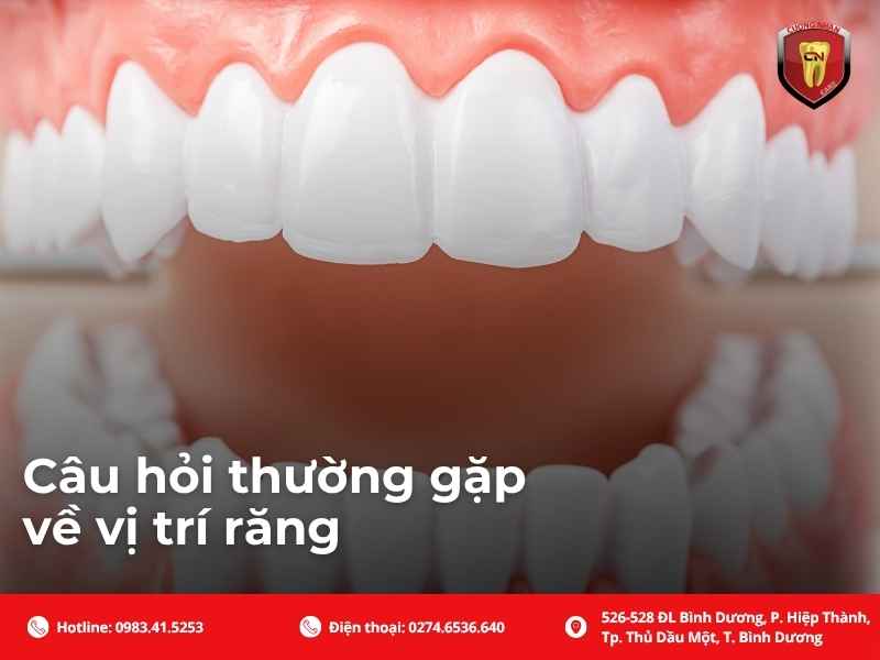 Câu hỏi thường gặp về vị trí răng