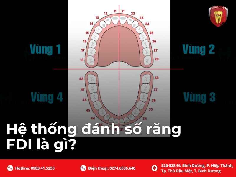 Hệ thống đánh số răng FDI là gì?