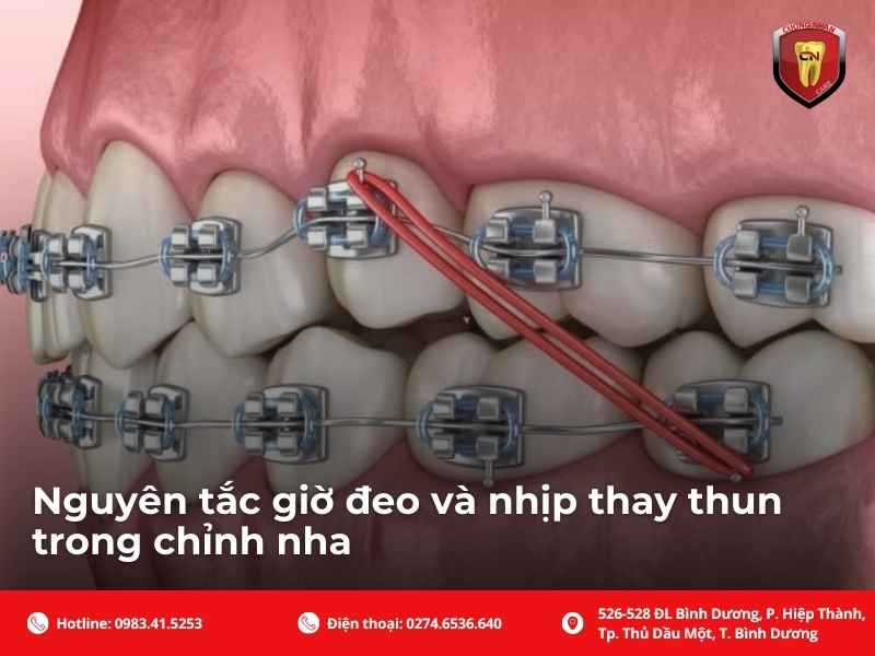 Nguyên tắc giờ đeo và nhịp thay thun trong chỉnh nha