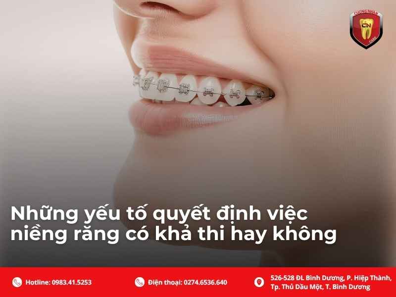 Những yếu tố quyết định việc niềng răng có khả thi hay không