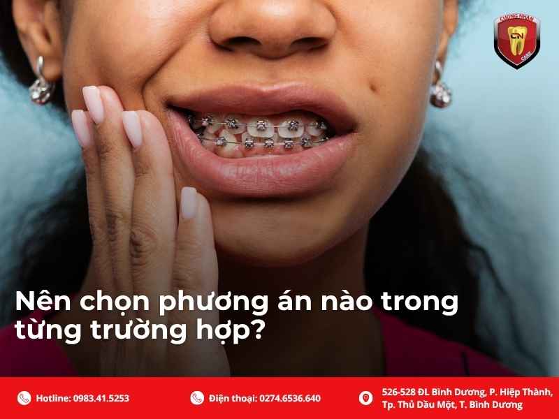 Nên chọn phương án nào trong từng trường hợp?