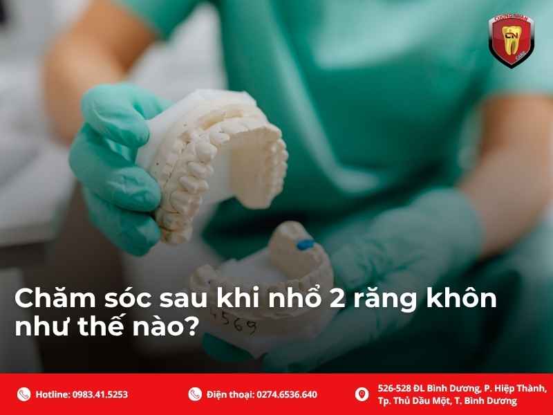 Chăm sóc sau khi nhổ 2 răng khôn như thế nào?