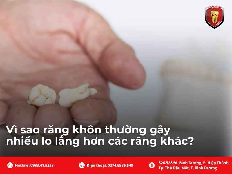 Vì sao răng khôn thường gây nhiều lo lắng hơn các răng khác?