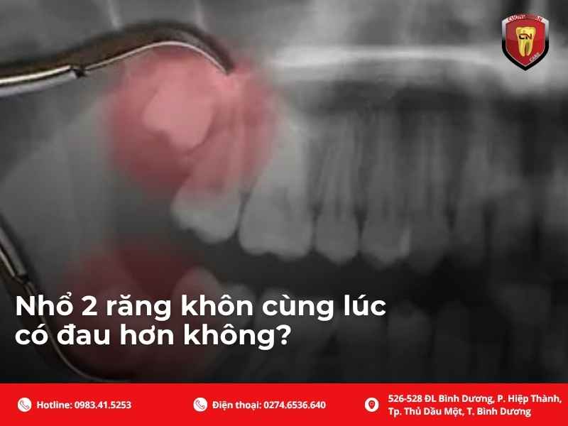 Nhổ 2 răng khôn cùng lúc có đau hơn không?
