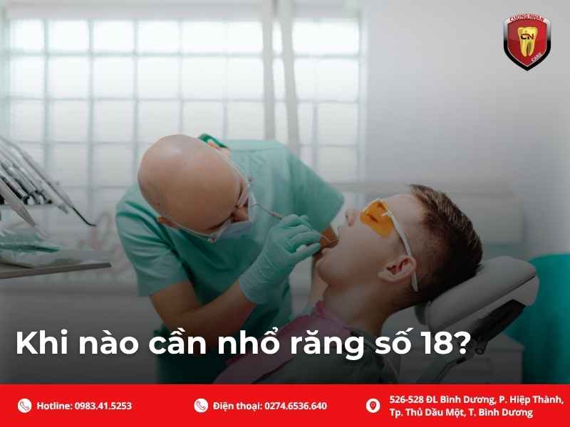 Khi nào cần nhổ răng số 18?