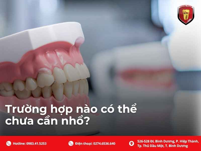 Trường hợp nào có thể chưa cần nhổ?