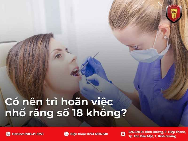 Có nên trì hoãn việc nhổ răng số 18 không?