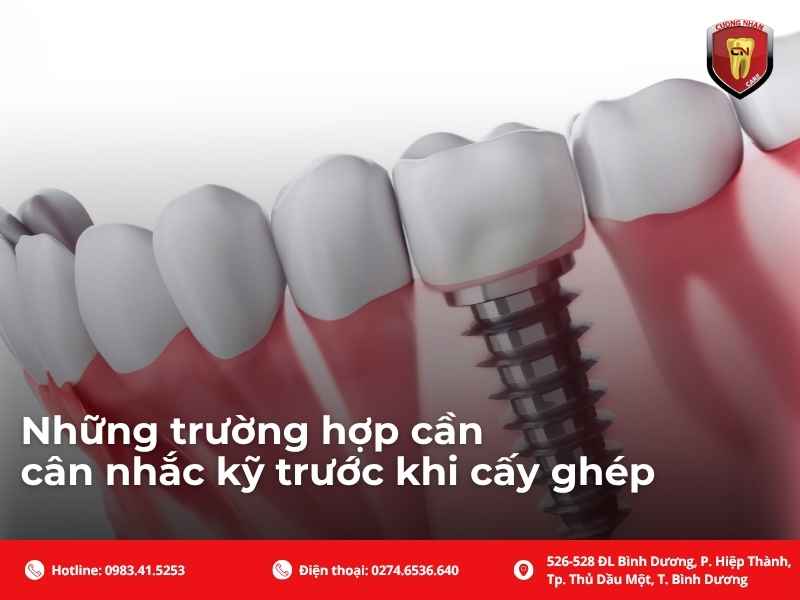 Trồng răng số 2 có đau không, mất bao lâu?