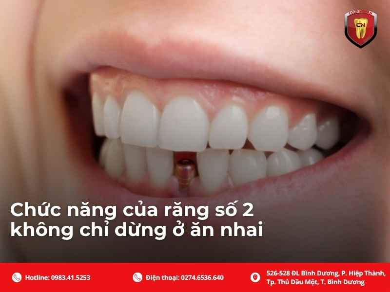 Đặc điểm riêng của răng cửa bên khiến vị trí này dễ gặp vấn đề