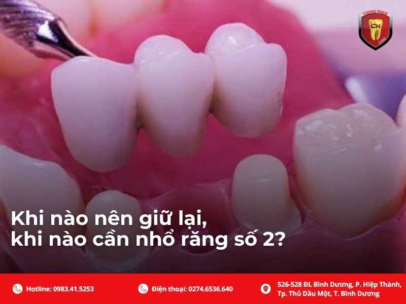 Những vấn đề thường gặp ở răng số 2