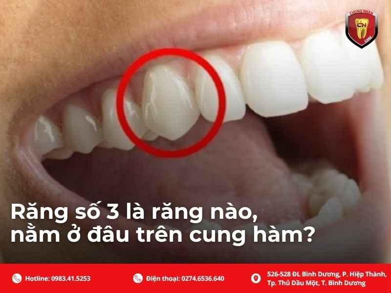 Răng số 3 là răng nào, nằm ở đâu trên cung hàm?