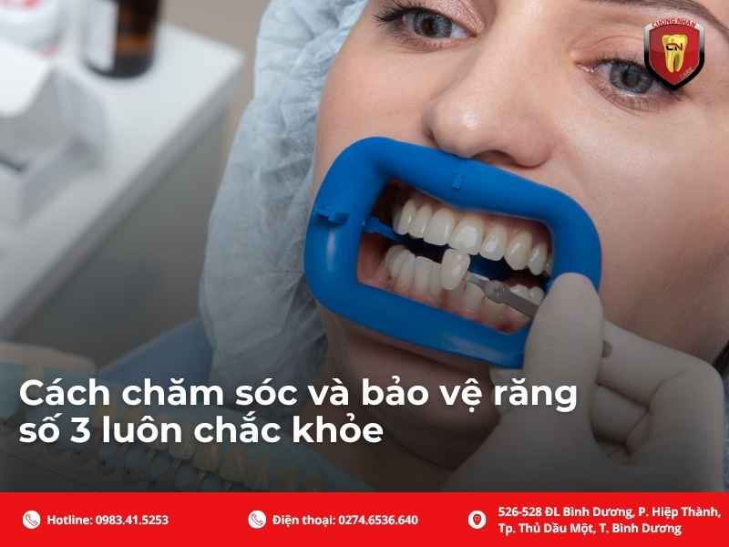 Cách chăm sóc và bảo vệ răng số 3 luôn chắc khỏe