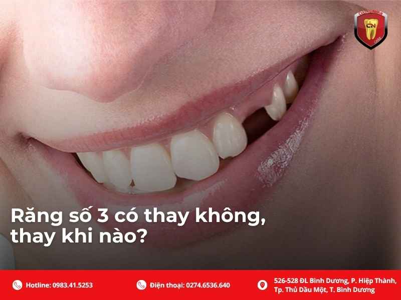 Răng số 3 có thay không, thay khi nào?