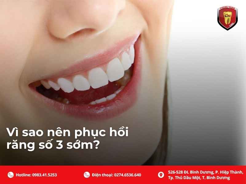 Vì sao nên phục hồi răng số 3 sớm?