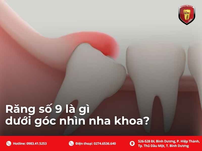 Răng số 9 là gì dưới góc nhìn nha khoa?