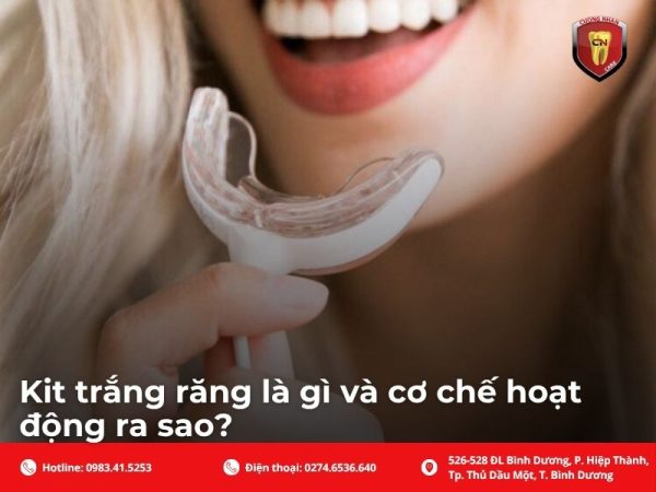 Kit trắng răng là gì và cơ chế hoạt động ra sao?