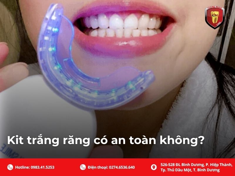 Kit trắng răng có an toàn không?