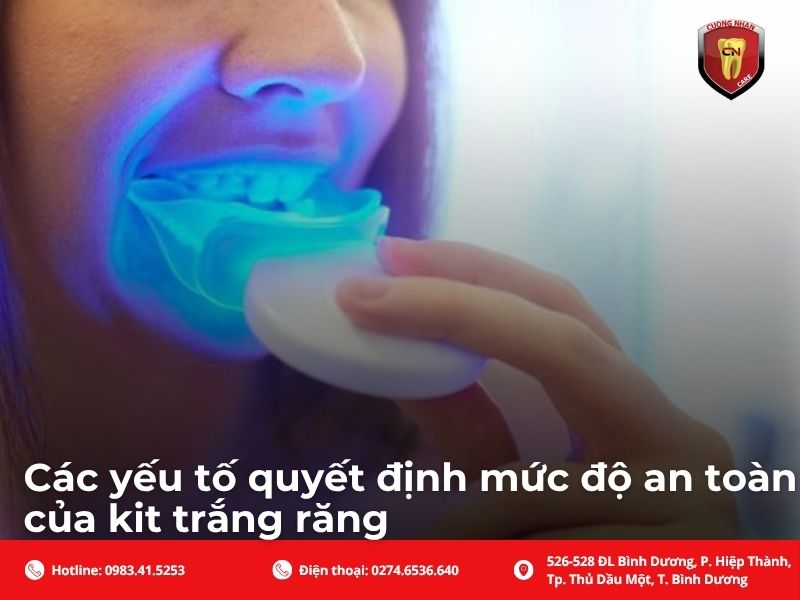Các yếu tố quyết định mức độ an toàn của kit trắng răng