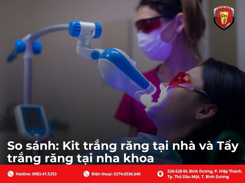 So sánh: Kit trắng răng tại nhà và Tẩy trắng răng tại nha khoa