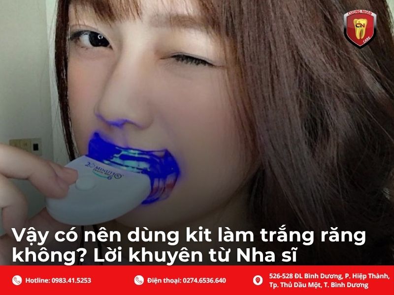 Vậy có nên dùng kit làm trắng răng không? Lời khuyên từ Nha sĩ
