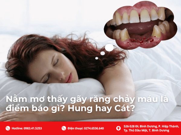 Giải Mã Điềm Báo: Mơ Gãy Răng Chảy Máu - Điềm Xấu Hay Tốt?